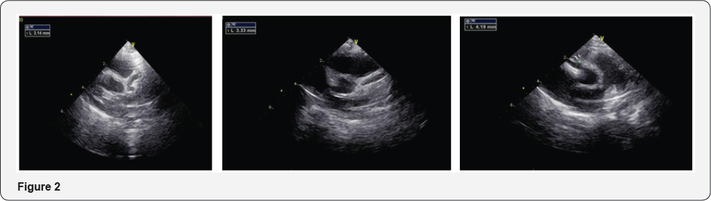 Click here to view Large Figure 1