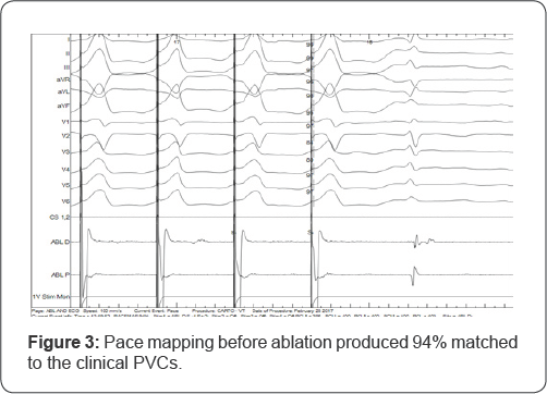 Click here to view Large Figure 1