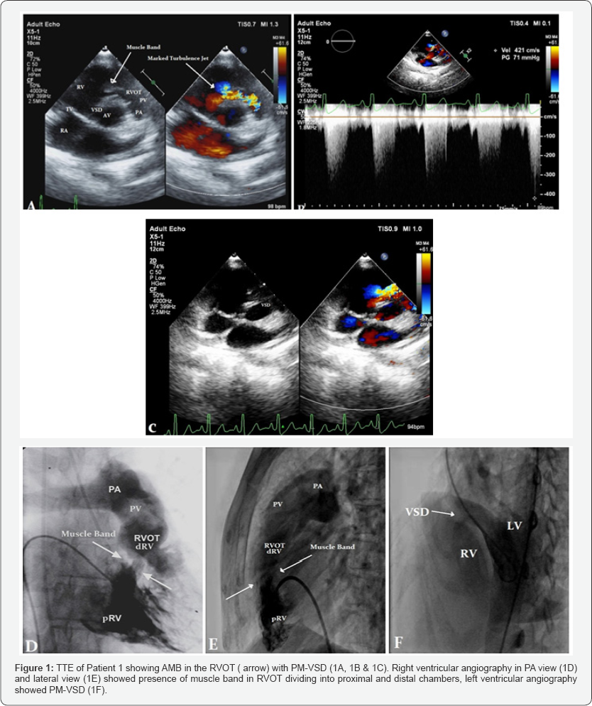 Click here to view Large Figure 1