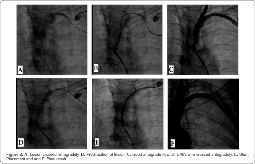 Click here to view Large Figure 1