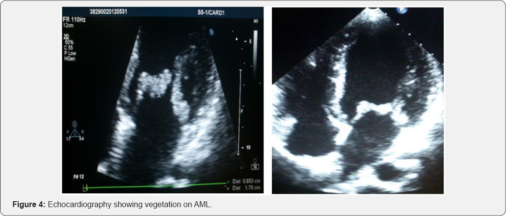 Click here to view Large Figure 4