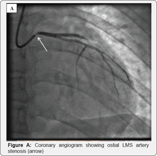 Click here to view Large Figure A