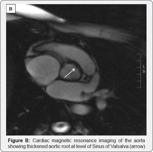 Click here to view Large Figure B