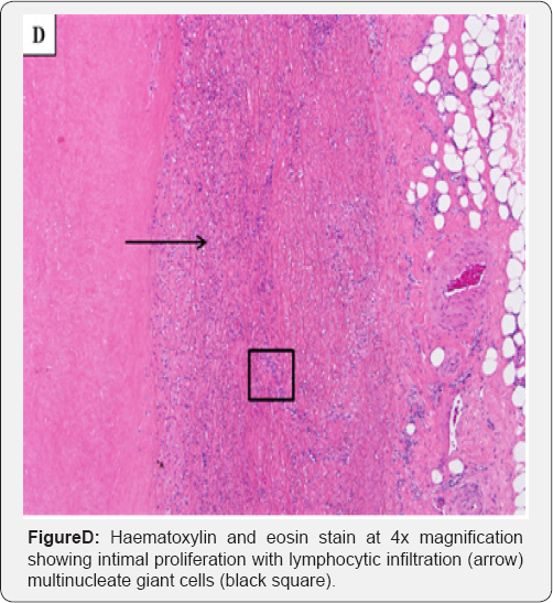Click here to view Large Figure D