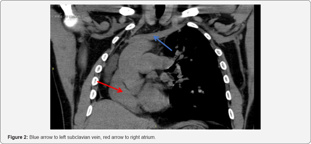 Click here to view Large Figure 2