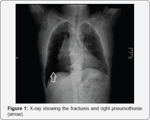Click here to view Large Figure 1