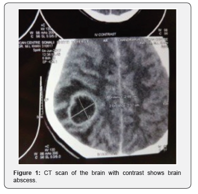 Click here to view Large Figure 1