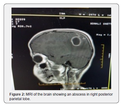 Click here to view Large Figure 2