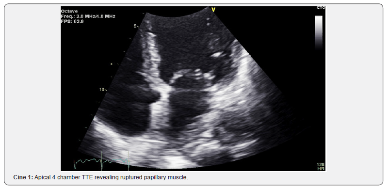 Click here to view Large Cine 1