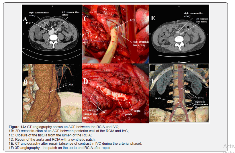 Click here to view Large Figure 1