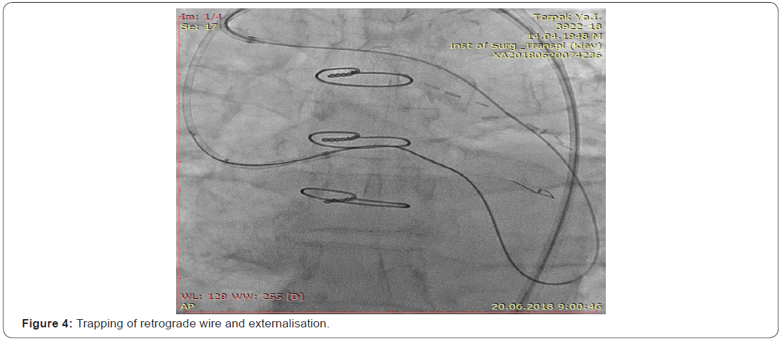 Click here to view Large Figure 4
