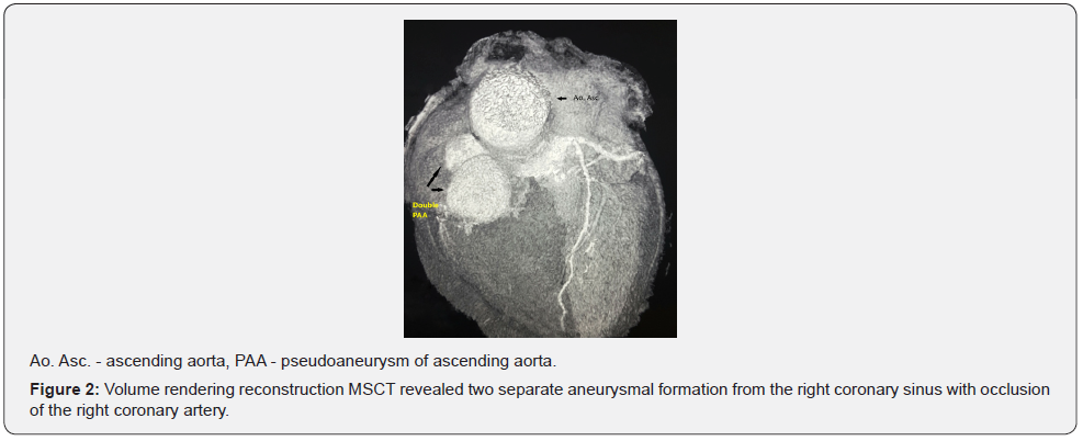 Click here to view Large Figure 2