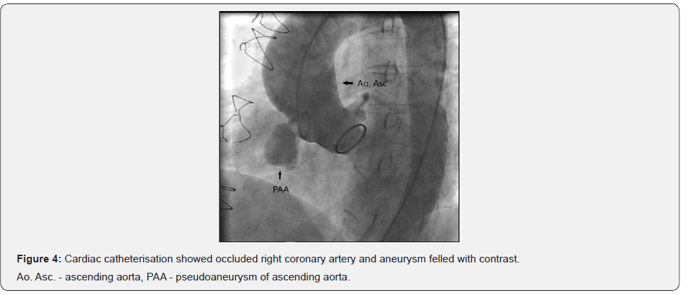 Click here to view Large Figure 4
