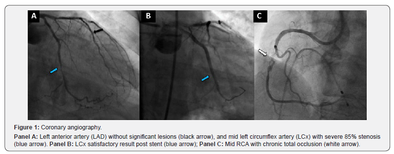 Click here to view Large Figure 1 Journal of Cardiology & Cardiovascular Therapy