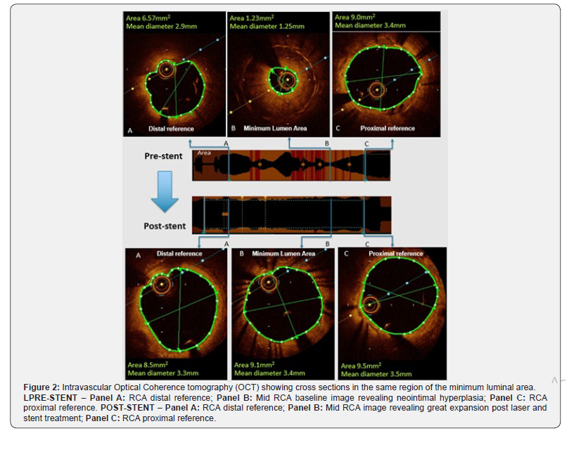 Click here to view Large Figure 2 Journal of Cardiology & Cardiovascular Therapy