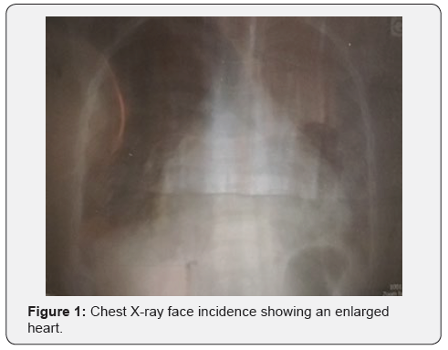Click here to view Large Figure 1 Journal of Cardiology & Cardiovascular Therapy