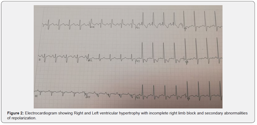 Click here to view Large Figure 2 Journal of Cardiology & Cardiovascular Therapy