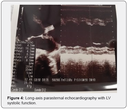 Click here to view Large Figure 4 Journal of Cardiology & Cardiovascular Therapy