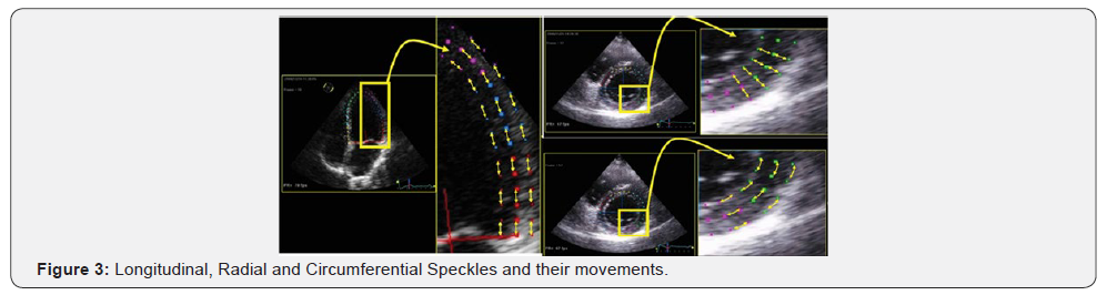 Click here to view Large Figure 3 Journal of Cardiology & Cardiovascular Therapy