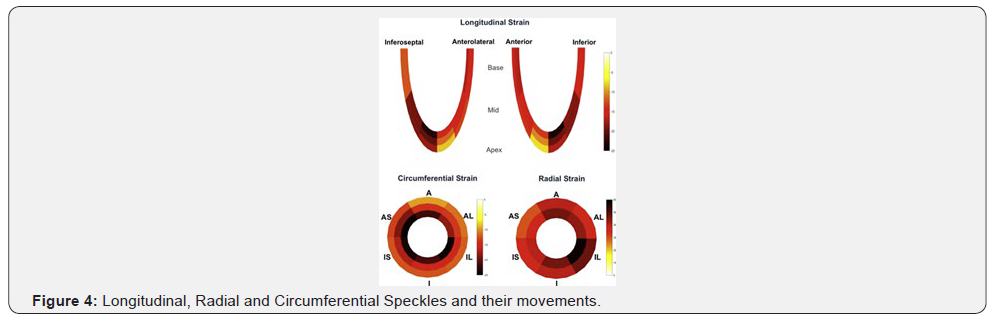 Click here to view Large Figure 4 Journal of Cardiology & Cardiovascular Therapy