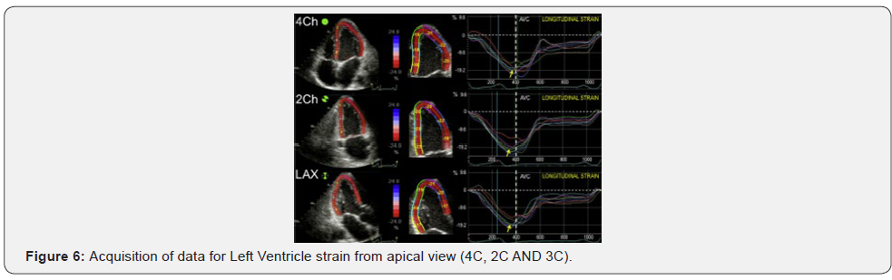 Click here to view Large Figure 6 Journal of Cardiology & Cardiovascular Therapy