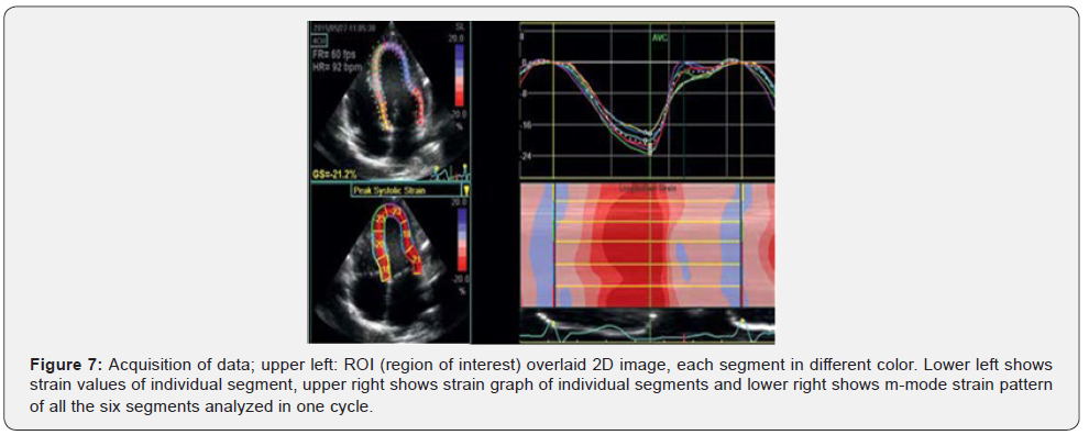 Click here to view Large Figure 7 Journal of Cardiology & Cardiovascular Therapy