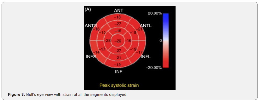 Click here to view Large Figure 8 Journal of Cardiology & Cardiovascular Therapy