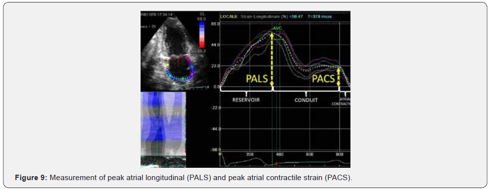 Click here to view Large Figure 9 Journal of Cardiology & Cardiovascular Therapy
