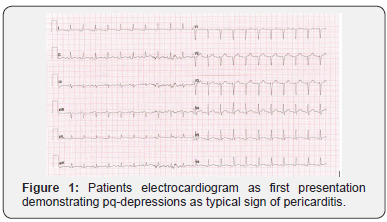 Click here to view Large Figure 1 Journal of Cardiology & Cardiovascular Therapy
