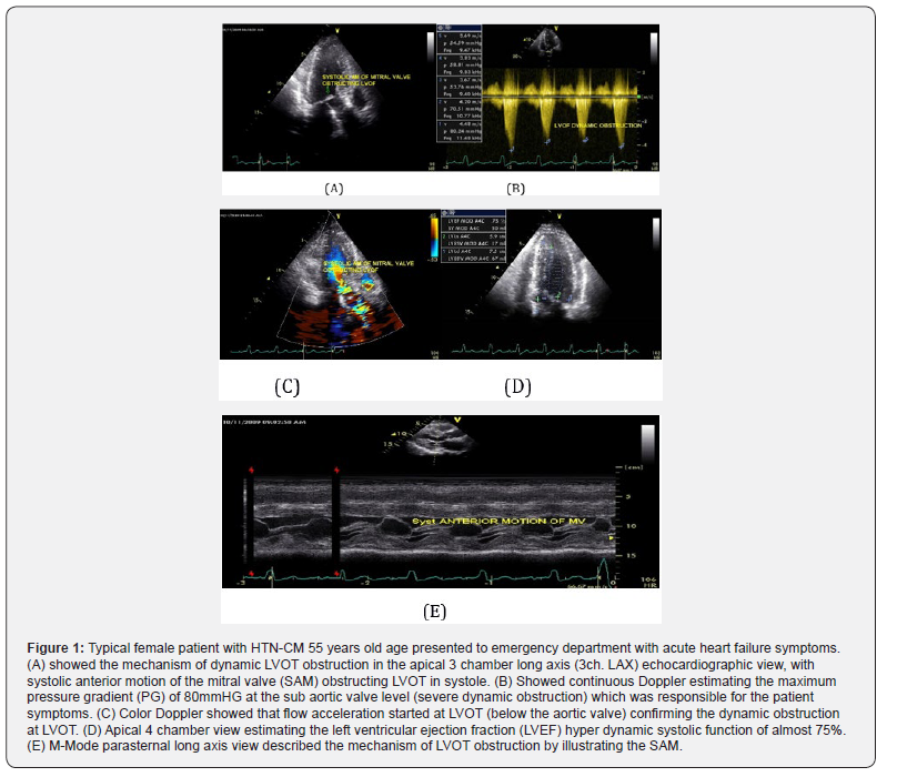 Click here to view Large Figure 1 Journal of Cardiology & Cardiovascular Therapy