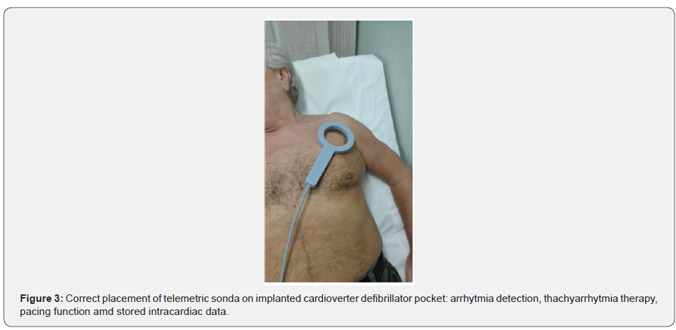 Click here to view Large Figure 3 Journal of Cardiology & Cardiovascular Therapy