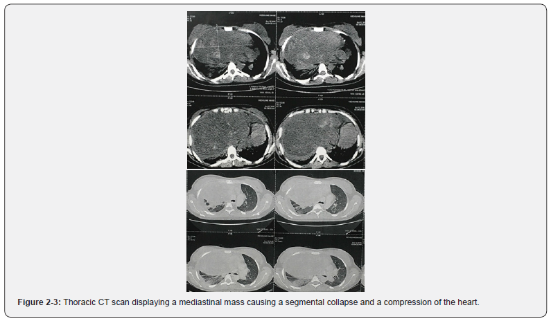 Click here to view Large Figure 2