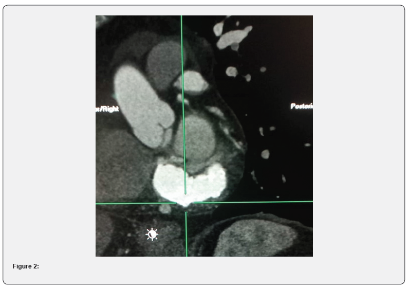 Click here to view Large Figure 2