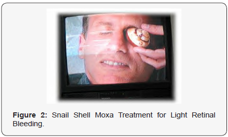 Click here to view Large Figure 2