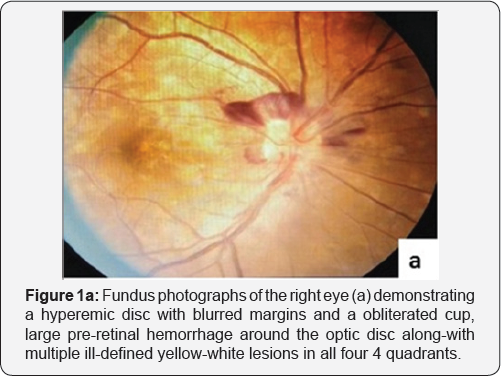 Click here to view Large Figure 1