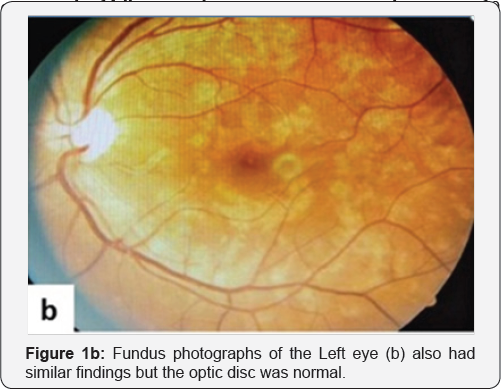 Click here to view Large Figure 1