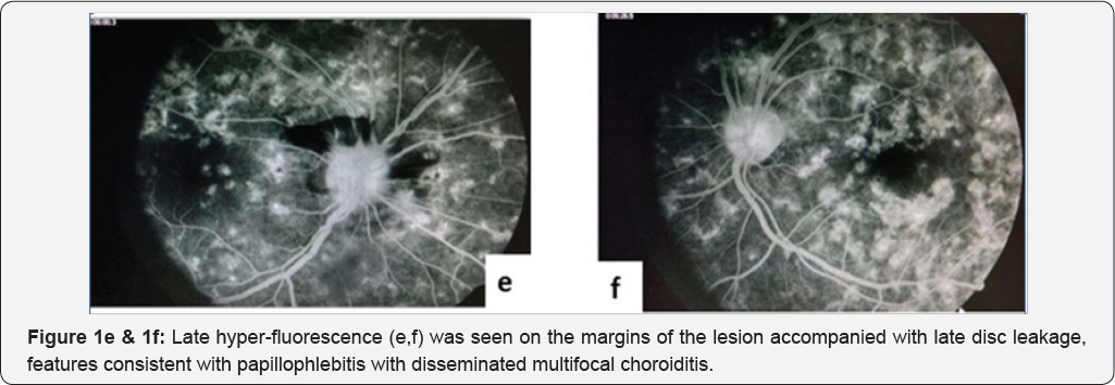 Click here to view Large Figure 1
