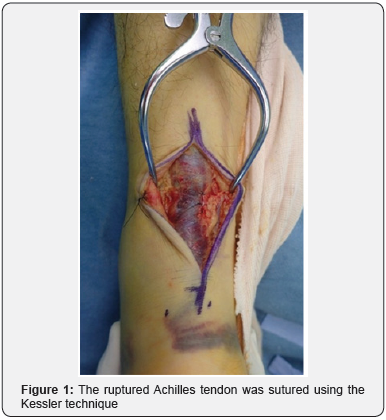 Click here to view Large Figure 1