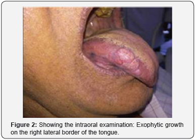 Click here to view Large Figure 2