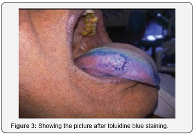 Click here to view Large Figure 3