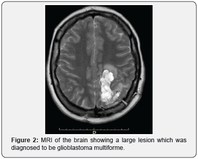 Click here to view Large Figure 2