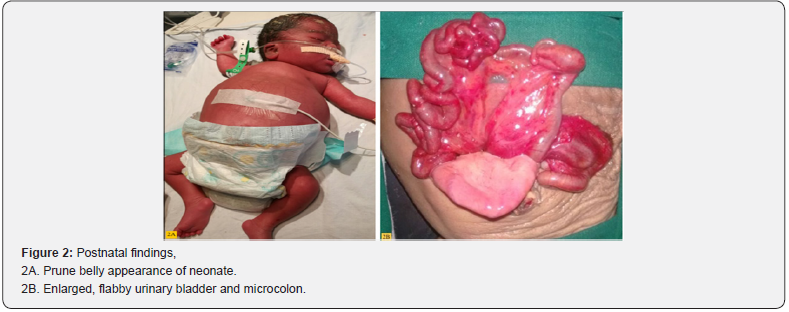 Click here to view Large Figure 2