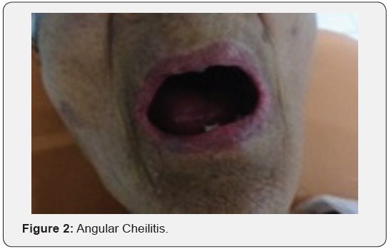 Click here to view Large Figure 2