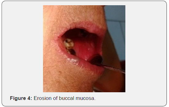 Click here to view Large Figure 4