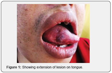 Click here to view Large Figure 1