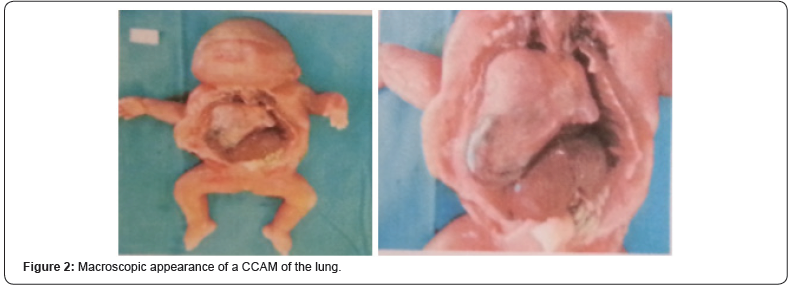 Click here to view Large Figure 2