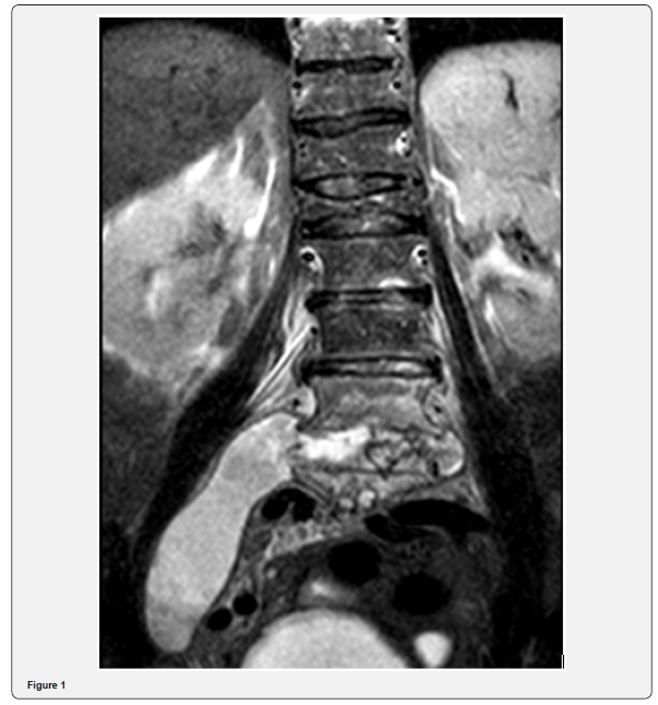 Click here to view Large Figure 1