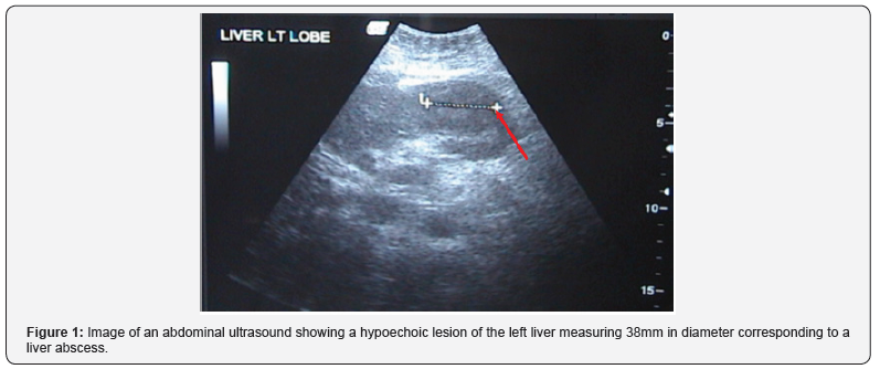 Click here to view Large Figure 1