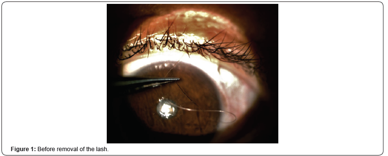 Click here to view Large Figure 1