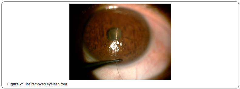 Click here to view Large Figure 2